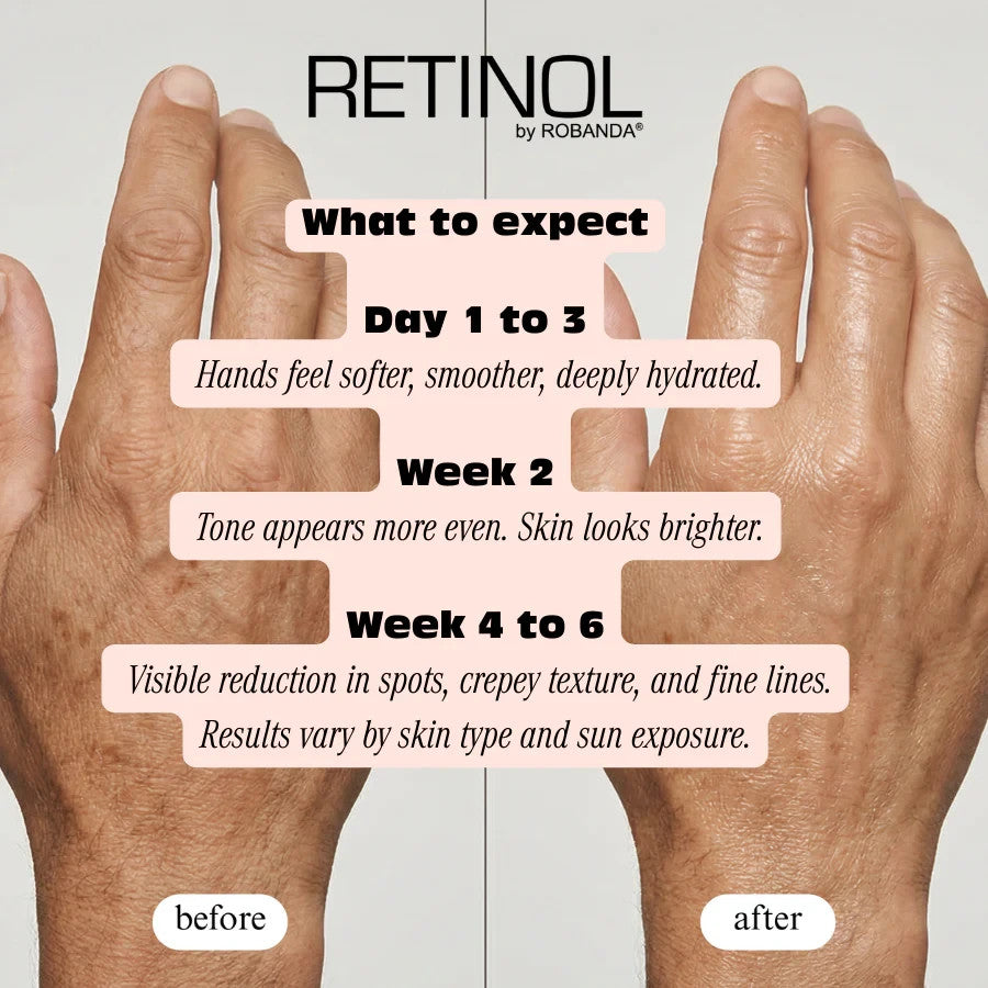 Robanda Retinol Hand Anti-Aging Treatment 3 oz