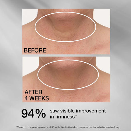 Strivectin TL Advanced Tightening Neck Cream Plus 1.7 oz