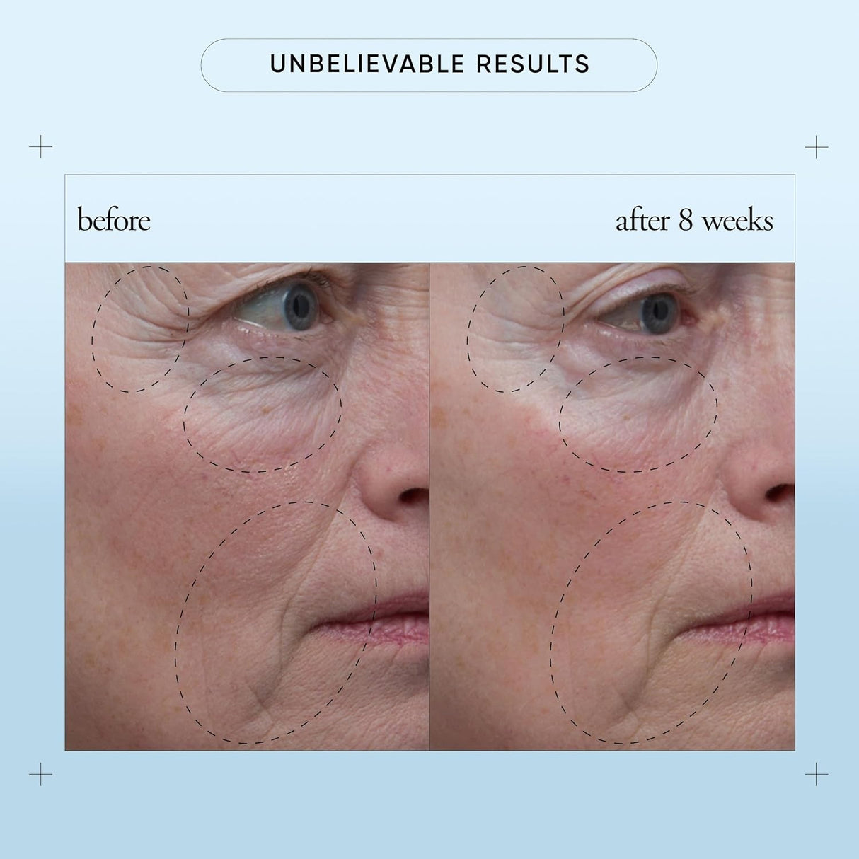 Philosophy When Hope Is Not Enough Facial Firming Serum 1 oz