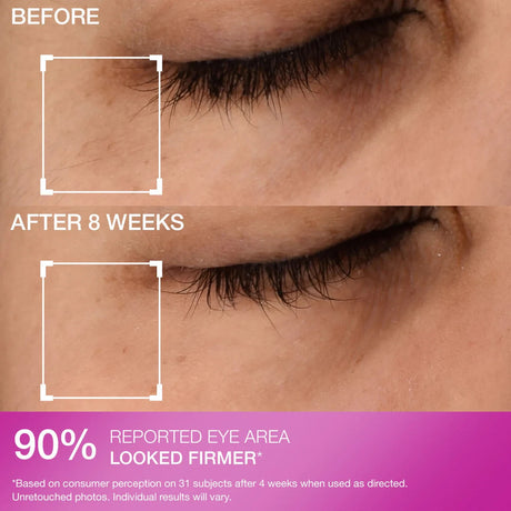 Strivectin Super-C Dark Circle Brightening Eye Serum