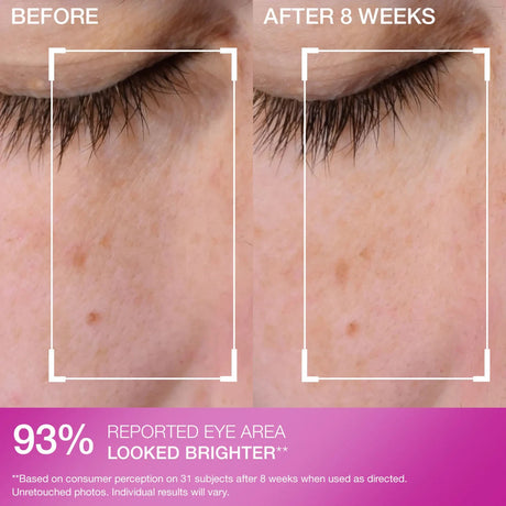 Strivectin Super-C Dark Circle Brightening Eye Serum
