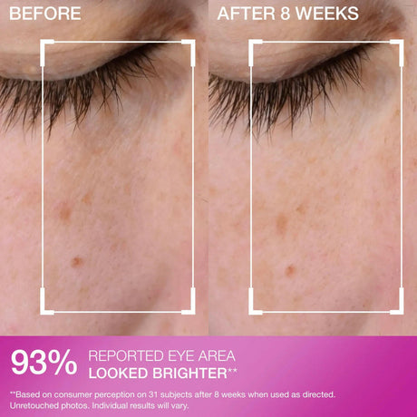 Strivectin Super-C Dark Circle Brightening Eye Serum