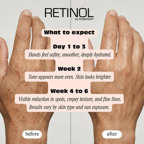 Robanda Retinol Hand Anti-Aging Treatment 3 oz