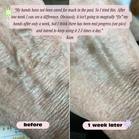 Robanda Retinol Hand Anti-Aging Treatment 3 oz