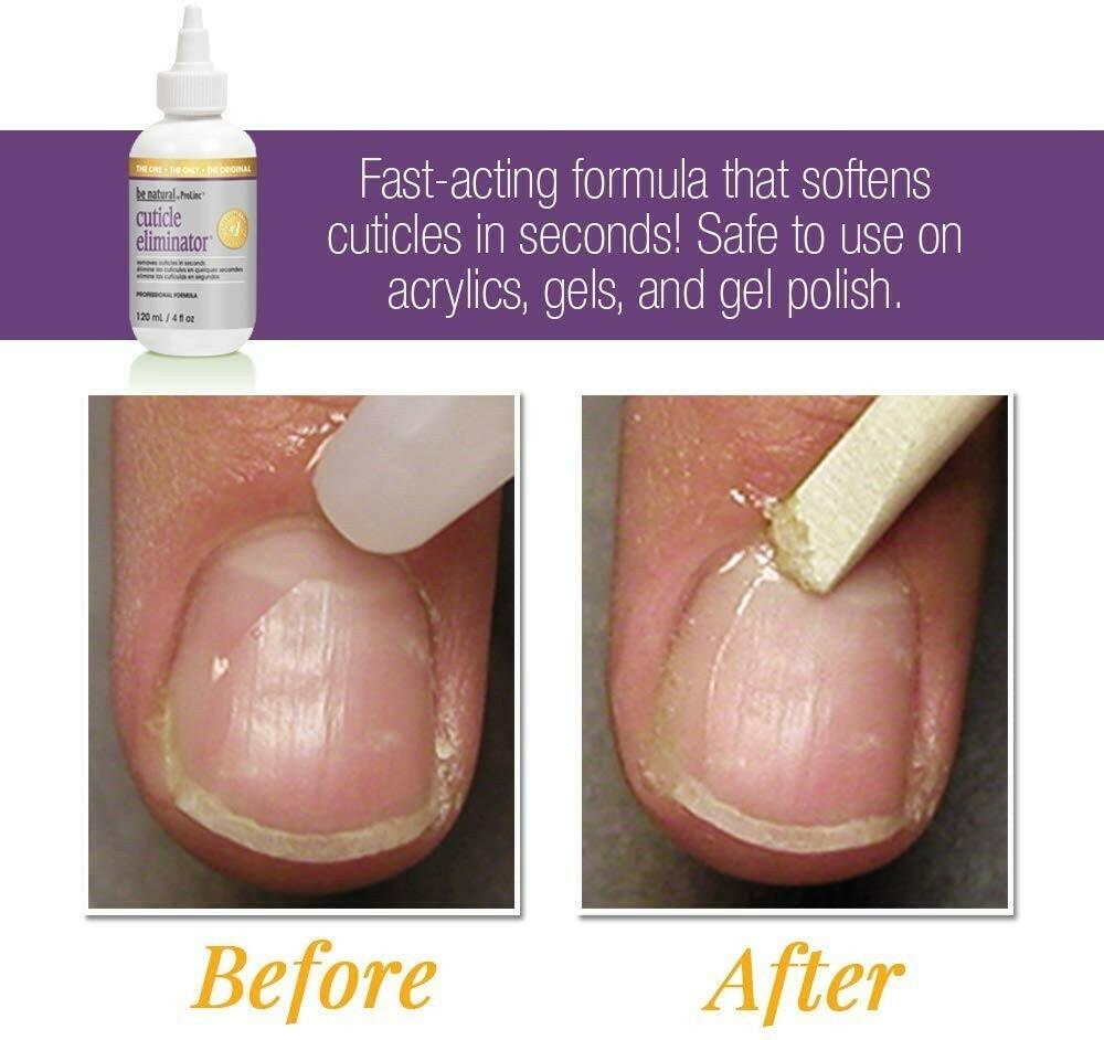 ProLinc Be Natural Cuticle Eliminator 18oz