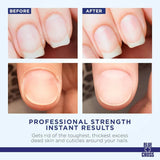 Blue Cross Cuticle Remover 32 oz