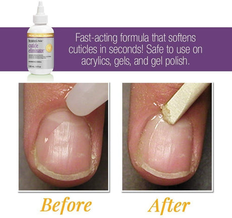 ProLinc Be Natural Cuticle Eliminator 18oz