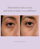 Exuviance Bright Eyes Dark Circle Corrector
