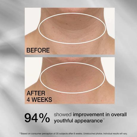 Strivectin TL Advanced Tightening Neck Cream Plus 1.7 oz