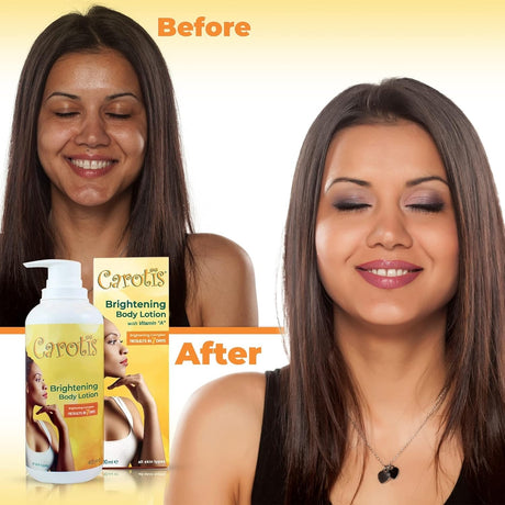 Carotis Brightening Body Lotion with Vitamin "A" 13.5 oz