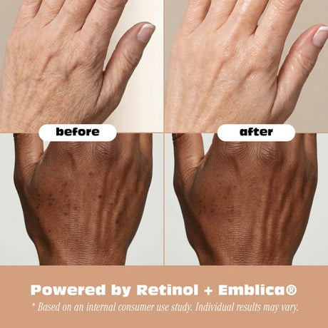 Robanda Retinol Hand Anti-Aging Treatment 3 oz