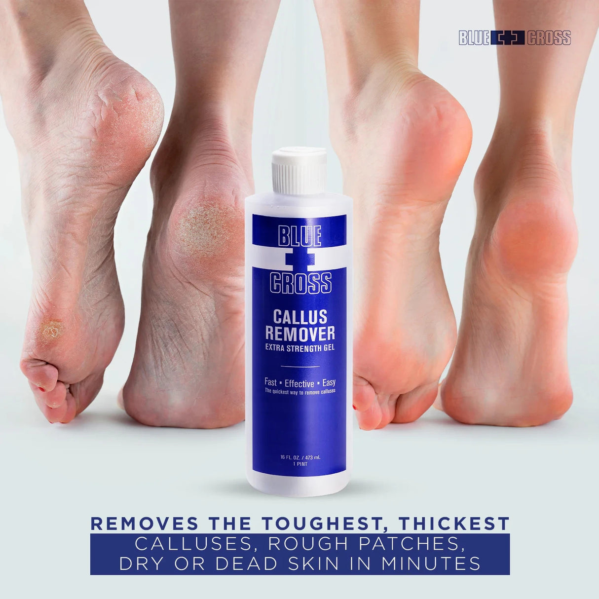 Blue Cross Callus Remover 32 oz