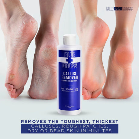 Blue Cross Callus Remover 32 oz