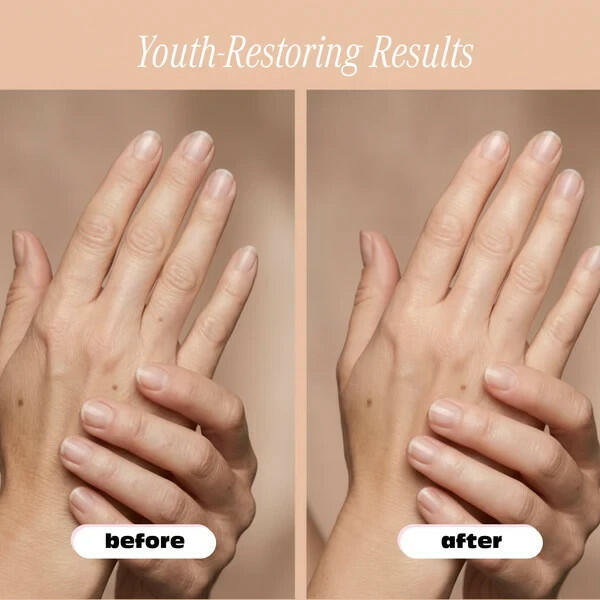 Robanda Retinol Hand Anti-Aging Treatment 3 oz
