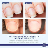 Blue Cross Cuticle Remover 32 oz
